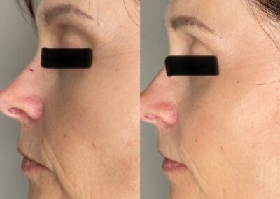 centre esthétique decines Jetpeel