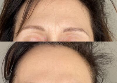 centre esthétique decines Jetpeel